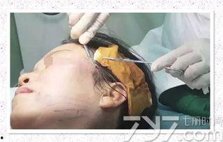 线雕操作视频全过程,从入门到精通的操作视频回顾